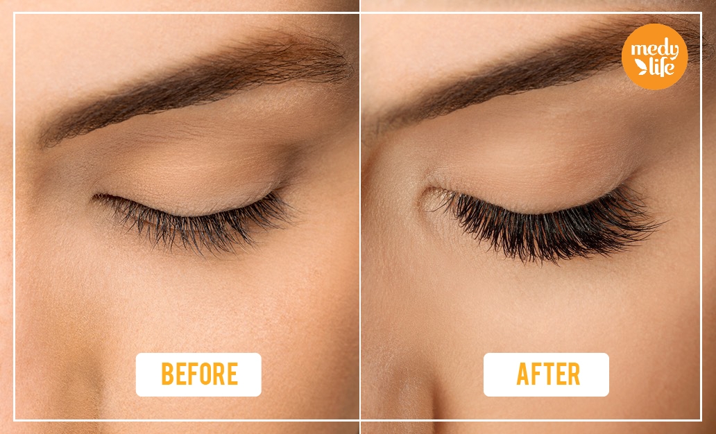 How to Grow Eyelashes Fast in a week with Natural Home Remedies?